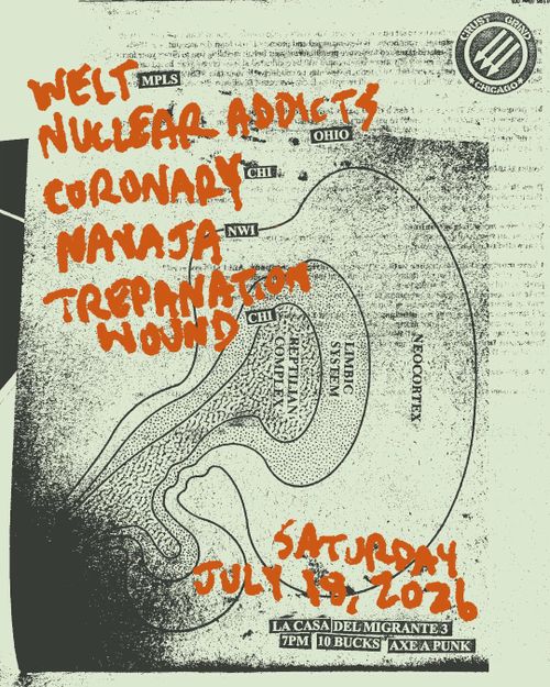 Welt, Nuclear Addicts, Coronary, Navaja, Trepanation Wound